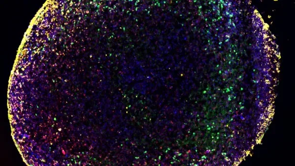 Protocol Organoids Neurospheres