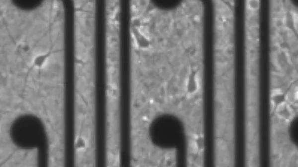 Research Project Neural Diversity