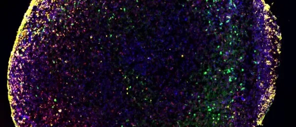 Protocol Organoids Neurospheres